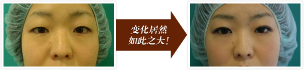 变化居然如此之大！