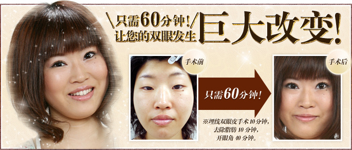 只需60分钟！让您的双眼发生巨大改变！ ※埋线双眼皮手术10分钟，去除脂肪10分钟，开眼角40分钟