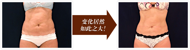 变化居然如此之大！