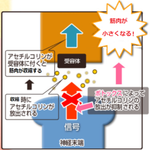 えらボトックスの原理