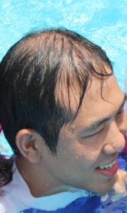 元神賢太のハゲ