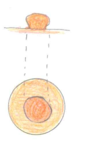 乳首の先端が大きい