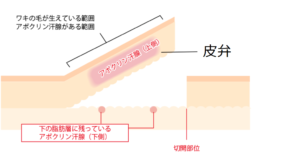 アポクリン汗腺の位置