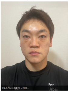 おばたのお兄さんの整形後