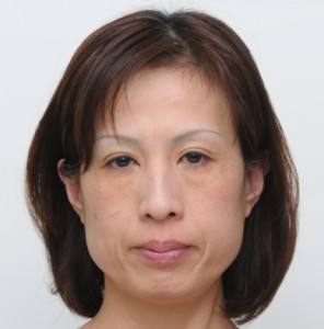 FL1前縮小 FL1前縮小