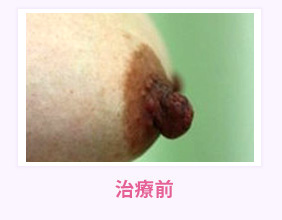 治療前