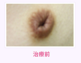 治療前