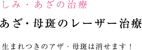 あざ・母斑のレーザー治療