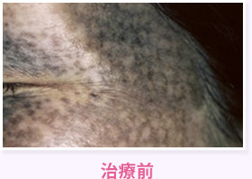 治療前