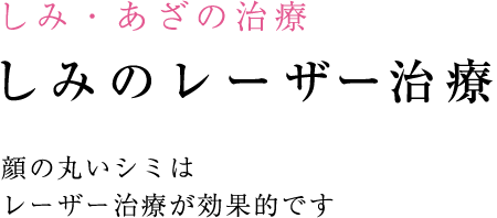 顔の丸いシミは レーザー治療が効果的です
