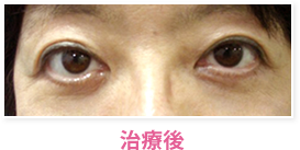 治療後