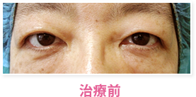 治療前
