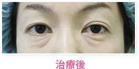 治療後