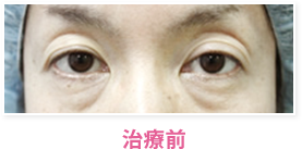 治療前