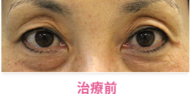治療前