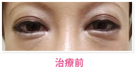 治療前