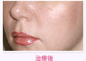 治療後