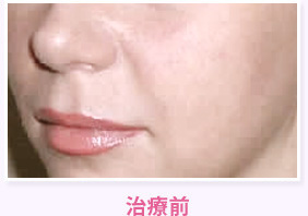 治療前