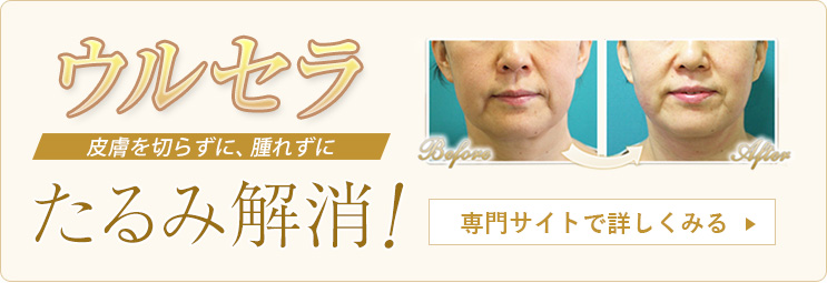 ウルセラ専門サイトへ