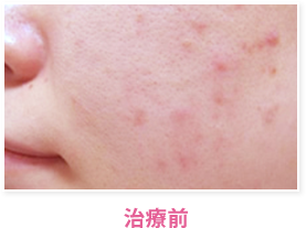 治療前
