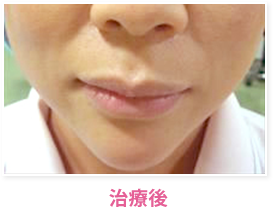 治療後