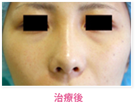 治療後