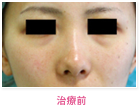 治療前