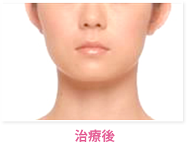 治療後