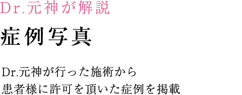 Dr.元神が解説 症例写真 Dr.元神が行った施術から患者様に許可を頂いた症例を掲載しています。