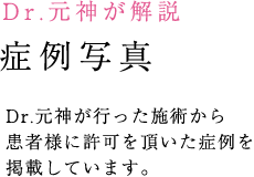 Dr.元神が解説 症例写真 Dr.元神が行った施術から患者様に許可を頂いた症例を掲載しています。