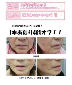 スプリングスレッドのお知らせ！（新製品情報）