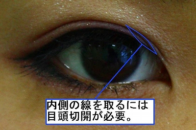 二重 二重