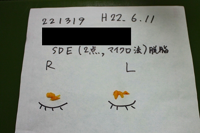 脂肪 脂肪