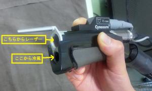 医療レーザー脱毛による永久脱毛の実際