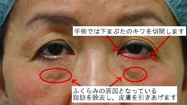 若返り 若返り