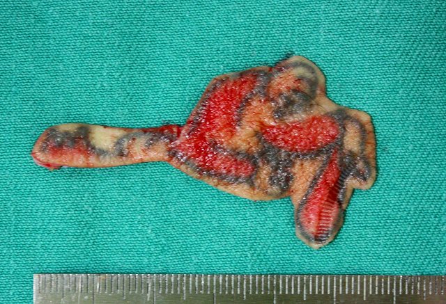 刺青　タトゥー2