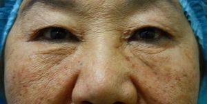 親孝行のアンチエイジング