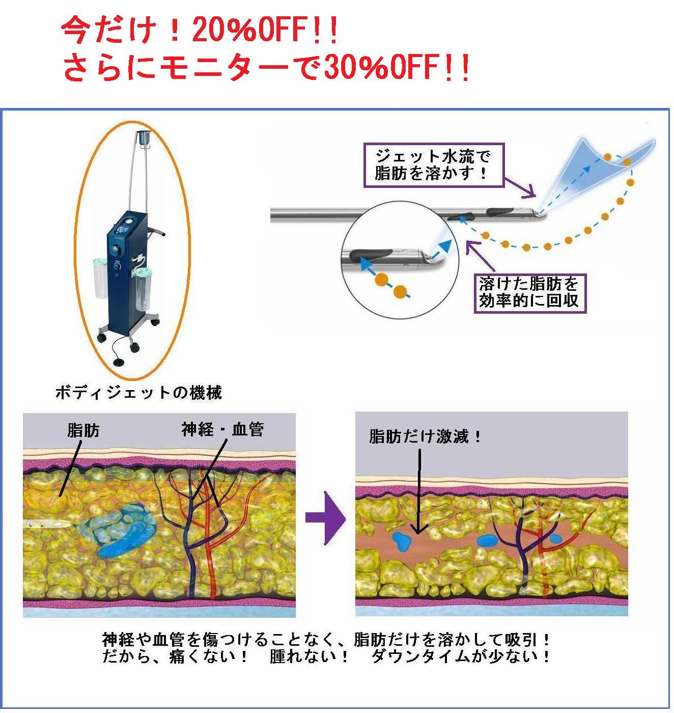 ボディジェット2 ボディジェット