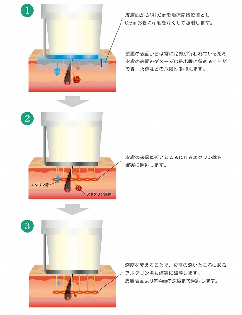 ビューホット