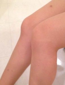 脱毛 脱毛