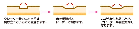 クレーター説明