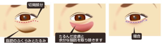 説明 説明