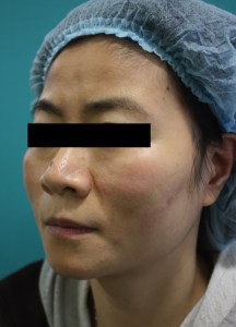 満足度が非常に高いスプリングスレッド
