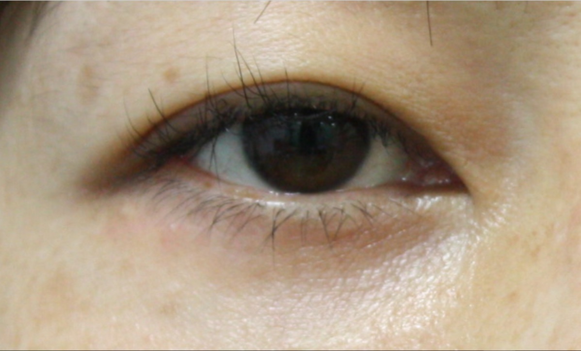 %e3%83%96%e3%83%ad%e3%82%b0%e5%8f%b3%e7%9b%ae%e3%82%a2%e3%83%83%e3%83%97