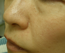 case_care2_002