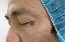 case_care2_003