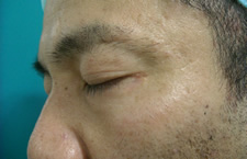 case_care2_004