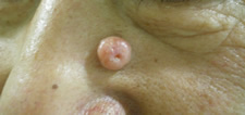 case_care2_005