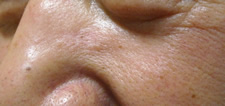 case_care2_006