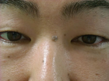 case_care2_007
